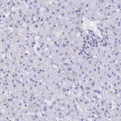 Immunohistochemistry-Paraffin: BTK Antibody [NBP1-89207]