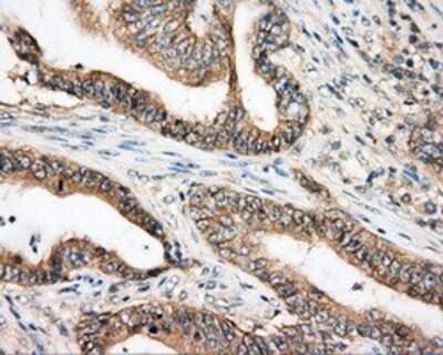 Immunohistochemistry: BTK Antibody (OTI3A2) - Azide and BSA Free [NBP2-70291]