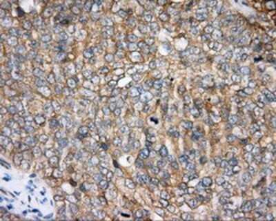 Immunohistochemistry: BTK Antibody (OTI3A2) - Azide and BSA Free [NBP2-70291]