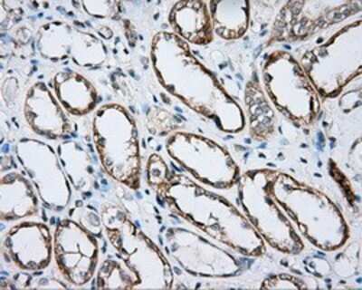 Immunohistochemistry: BTK Antibody (OTI3A2) - Azide and BSA Free [NBP2-70291]