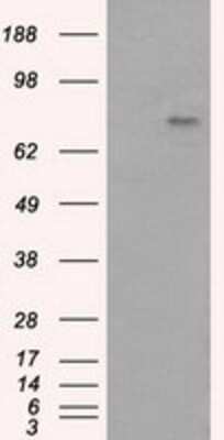 Western Blot: BTK Antibody (OTI3A2)Azide and BSA Free [NBP2-70291]