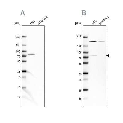 Western Blot: BTK Antibody [NBP1-89207]