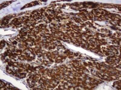 Immunohistochemistry: BTLA/CD272 Antibody (OTI2E4) [NBP2-45549]