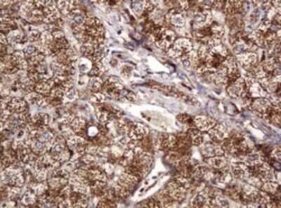 Immunohistochemistry: BTLA/CD272 Antibody (OTI2E4) [NBP2-45549]