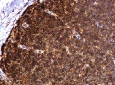 Immunohistochemistry: BTLA/CD272 Antibody (OTI2E4) [NBP2-45549]