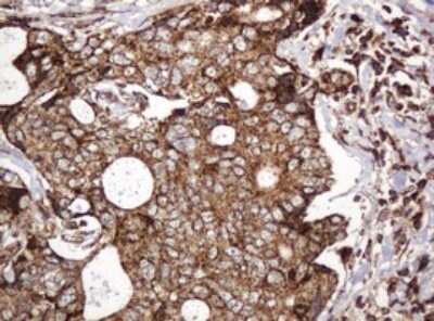 Immunohistochemistry: BTLA/CD272 Antibody (OTI2E4) [NBP2-45549]