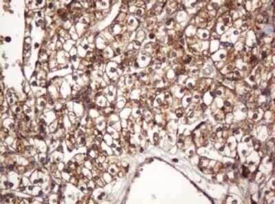 Immunohistochemistry: BTLA/CD272 Antibody (OTI2E4) [NBP2-45549]