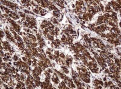 Immunohistochemistry: BTLA/CD272 Antibody (OTI2E4) [NBP2-45549]