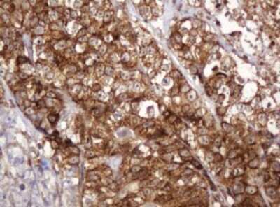 Immunohistochemistry: BTLA/CD272 Antibody (OTI2E4) [NBP2-45549]