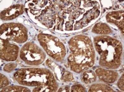 Immunohistochemistry: BTLA/CD272 Antibody (OTI2E4) [NBP2-45549]