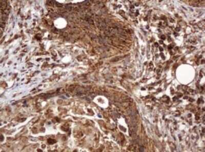Immunohistochemistry: BTLA/CD272 Antibody (OTI2E4) [NBP2-45549]