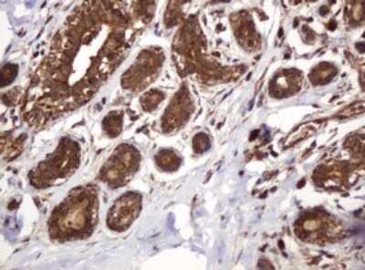 Immunohistochemistry: BTLA/CD272 Antibody (OTI2E4) [NBP2-45549]