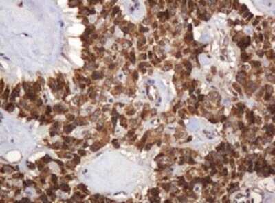 Immunohistochemistry: BTLA/CD272 Antibody (OTI2E4) [NBP2-45549]