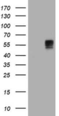 Western Blot: BTLA/CD272 Antibody (OTI2E4) [NBP2-45549]