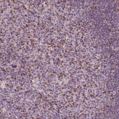 Immunohistochemistry-Paraffin: BTLA/CD272 Antibody [NBP2-49354]