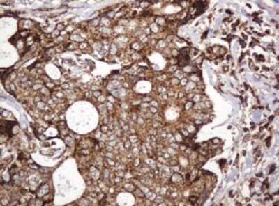 Immunohistochemistry: BTLA/CD272 Antibody (OTI2E4) - Azide and BSA Free [NBP2-72427]