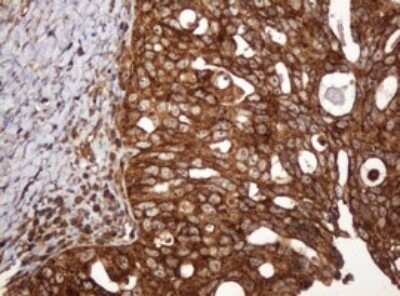 Immunohistochemistry: BTLA/CD272 Antibody (OTI2E4) - Azide and BSA Free [NBP2-72427]