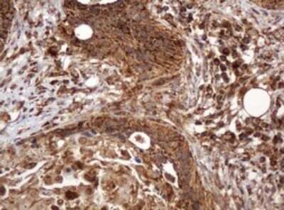 Immunohistochemistry: BTLA/CD272 Antibody (OTI2E4) - Azide and BSA Free [NBP2-72427]