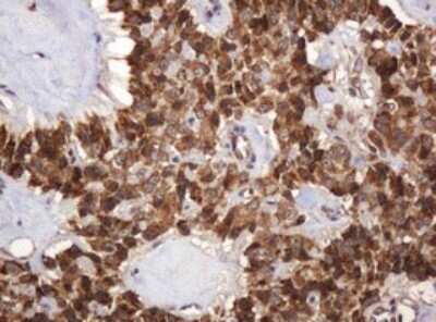 Immunohistochemistry: BTLA/CD272 Antibody (OTI2E4) - Azide and BSA Free [NBP2-72427]