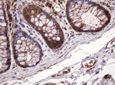 Immunohistochemistry: BTLA/CD272 Antibody (OTI2E4) - Azide and BSA Free [NBP2-72427]