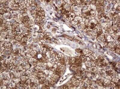 Immunohistochemistry: BTLA/CD272 Antibody (OTI2E4) - Azide and BSA Free [NBP2-72427]
