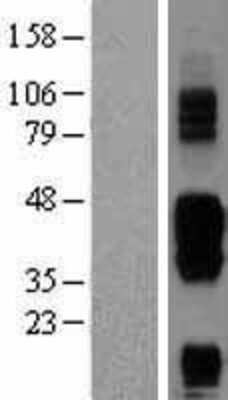 Western Blot: BTLA/CD272 Overexpression Lysate [NBP2-04442]