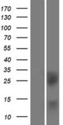 Western Blot: BTLA/CD272 Overexpression Lysate [NBP2-11441]