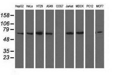 Western Blot: BTN1A1/Butyrophilin Antibody (OTI7B5) [NBP2-02864]