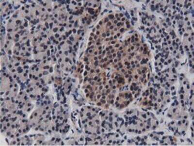 Immunohistochemistry: BTN1A1/Butyrophilin Antibody (OTI7B5) - Azide and BSA Free [NBP2-70299]