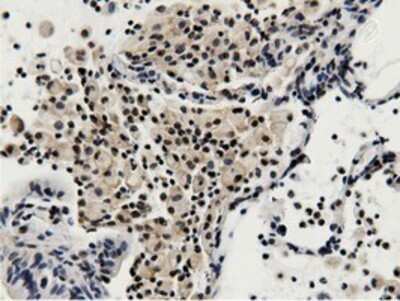 Immunohistochemistry: BTN1A1/Butyrophilin Antibody (OTI7B5) - Azide and BSA Free [NBP2-70299]