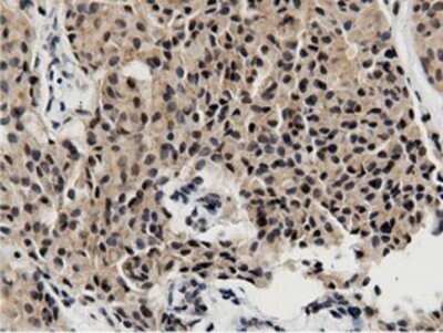 Immunohistochemistry: BTN1A1/Butyrophilin Antibody (OTI7B5) - Azide and BSA Free [NBP2-70299]