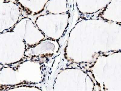 Immunohistochemistry: BTN1A1/Butyrophilin Antibody (OTI7B5) - Azide and BSA Free [NBP2-70299]