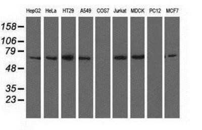 Western Blot: BTN1A1/Butyrophilin Antibody (OTI7B5)Azide and BSA Free [NBP2-70299]
