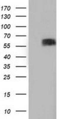 Western Blot: BTN1A1/Butyrophilin Antibody (OTI7B5)Azide and BSA Free [NBP2-70299]