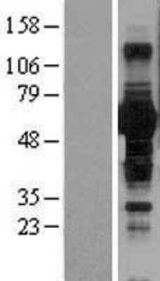 Western Blot: BTN1A1/Butyrophilin Overexpression Lysate [NBL1-08051]