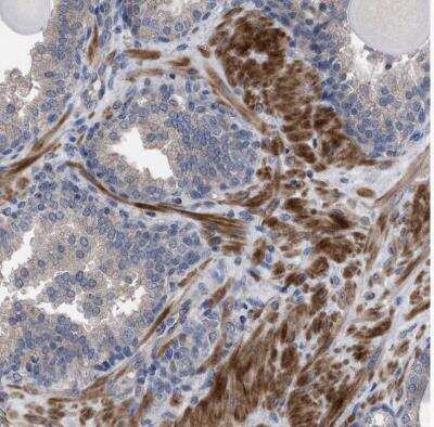 Immunohistochemistry-Paraffin: BTN2A1 Antibody [NBP1-88504]