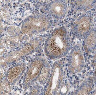 Immunohistochemistry-Paraffin: BTN2A1 Antibody [NBP1-88504]