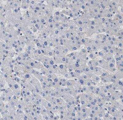 Immunohistochemistry-Paraffin: BTN2A1 Antibody [NBP1-88504]