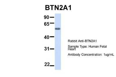 Western Blot: BTN2A1 Antibody [NBP1-62371]