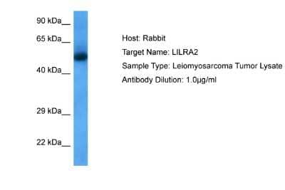 Western Blot: BTN2A1 Antibody [NBP2-87095]