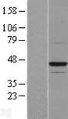 Western Blot: BTN2A1 Overexpression Lysate [NBL1-08052]