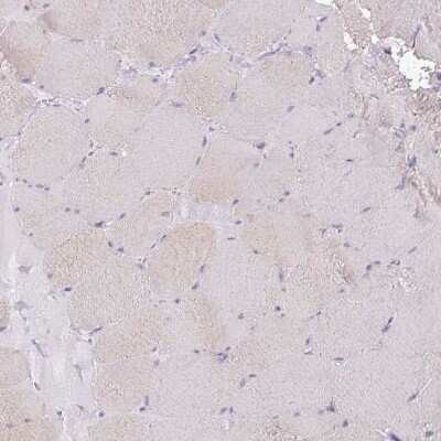 Immunohistochemistry-Paraffin: BTN2A2/Butyrophilin 2 Antibody [NBP2-14367]