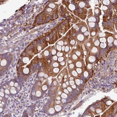 Immunohistochemistry-Paraffin: BTN2A2/Butyrophilin 2 Antibody [NBP2-14367]