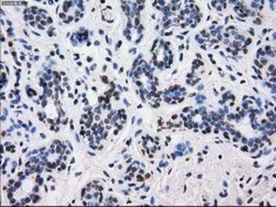 Immunohistochemistry: BTN3A2 Antibody (OTI1A6) - Azide and BSA Free [NBP2-71678]