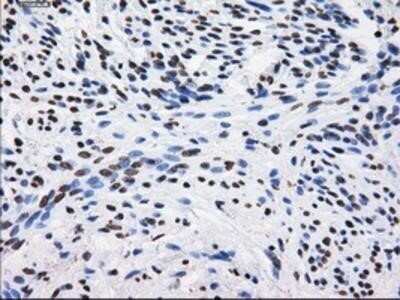 Immunohistochemistry: BTN3A2 Antibody (OTI1A6) - Azide and BSA Free [NBP2-71678]
