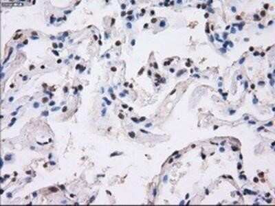 Immunohistochemistry: BTN3A2 Antibody (OTI1A6) - Azide and BSA Free [NBP2-71678]