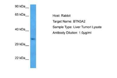 Western Blot: BTN3A2 Antibody [NBP2-86589]