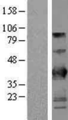 Western Blot: BTN3A2 Overexpression Lysate [NBL1-08054]