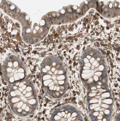 Immunohistochemistry-Paraffin: BTN3A3 Antibody [NBP1-88509]