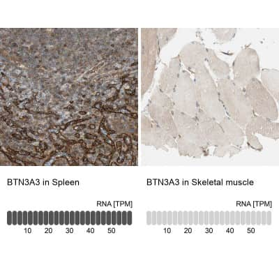 Immunohistochemistry-Paraffin: BTN3A3 Antibody [NBP1-88509]